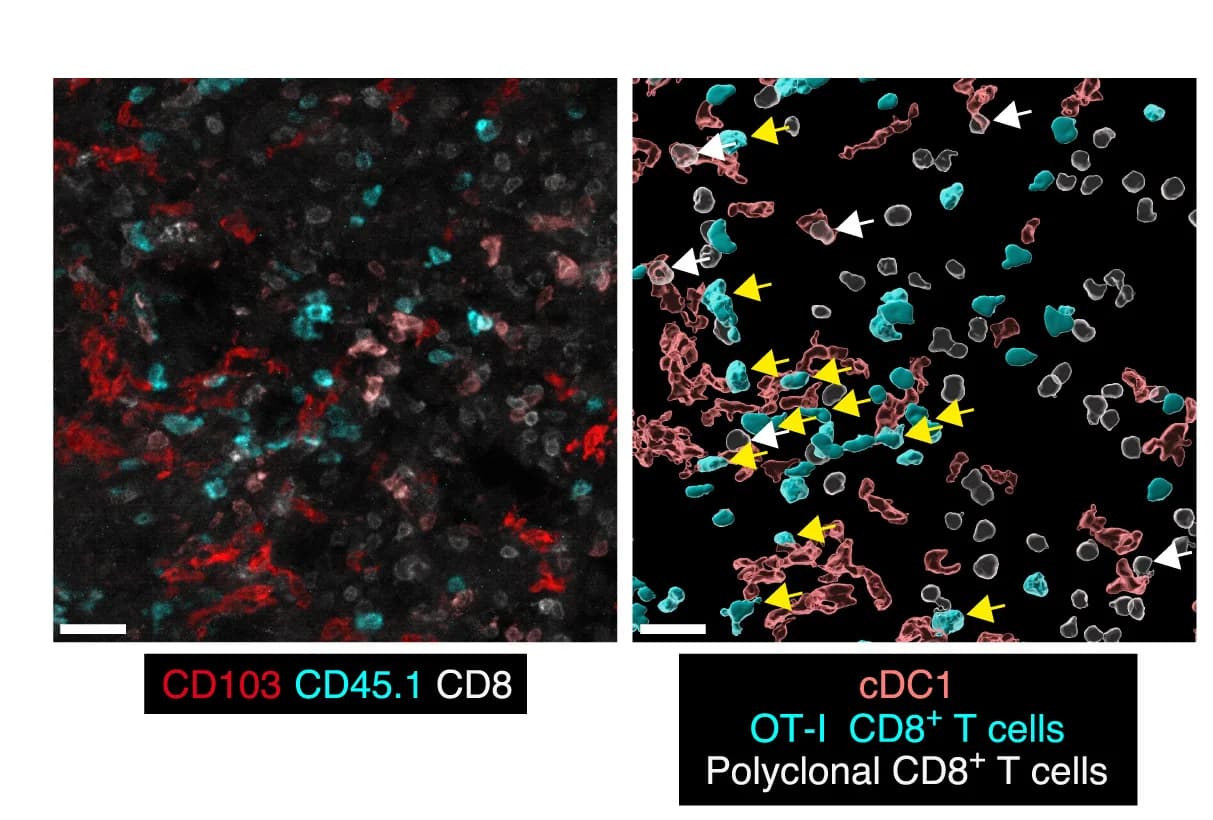 Open access visualization of Microscopy, Tumor Stroma, T Cells, cDC1