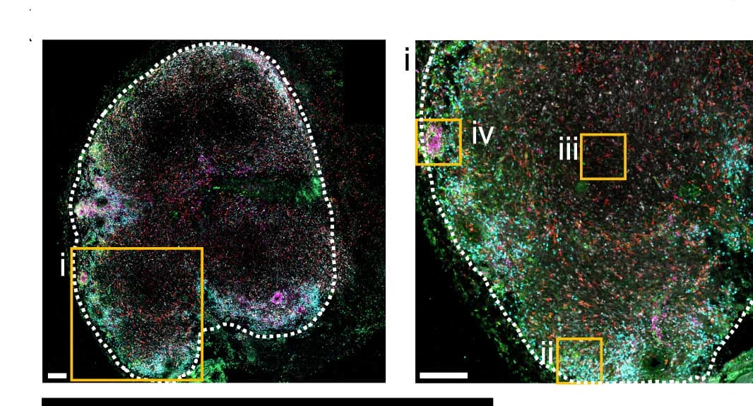 Open access visualization of Microscopy, cDC1 Subpopulations, Ki-67+CD8+T Cells, Cell Localization, Tissue Border