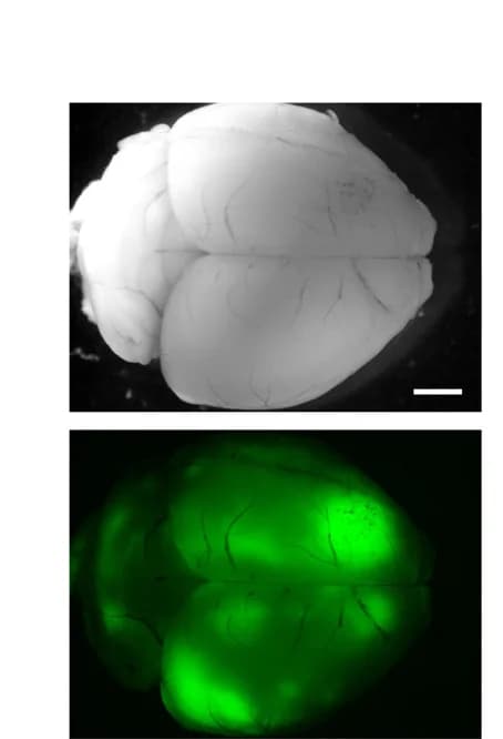 Open access visualization of Microscopy, Stereomicroscopy, Brain, GFP, Tumor Areas