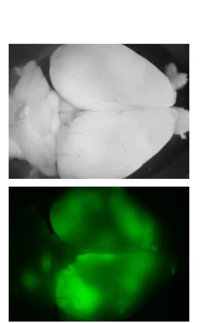 Open access visualization of Microscopy, Photo, Stereomicroscopy, Brain, GFP