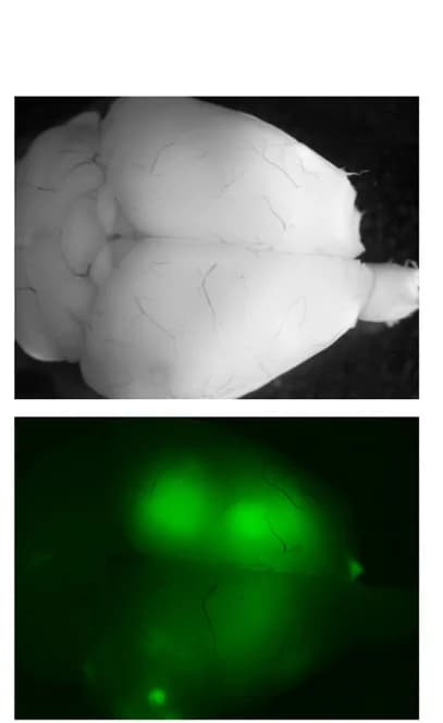 Open access visualization of Microscopy, Photo, Stereomicroscopy, Brain, GFP