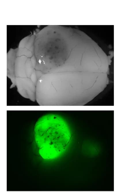 Open access visualization of Microscopy, Photo, Stereomicroscopy, Brain, GFP