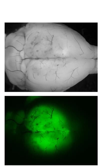 Open access visualization of Microscopy, Photo, Stereomicroscopy, Brain, GFP