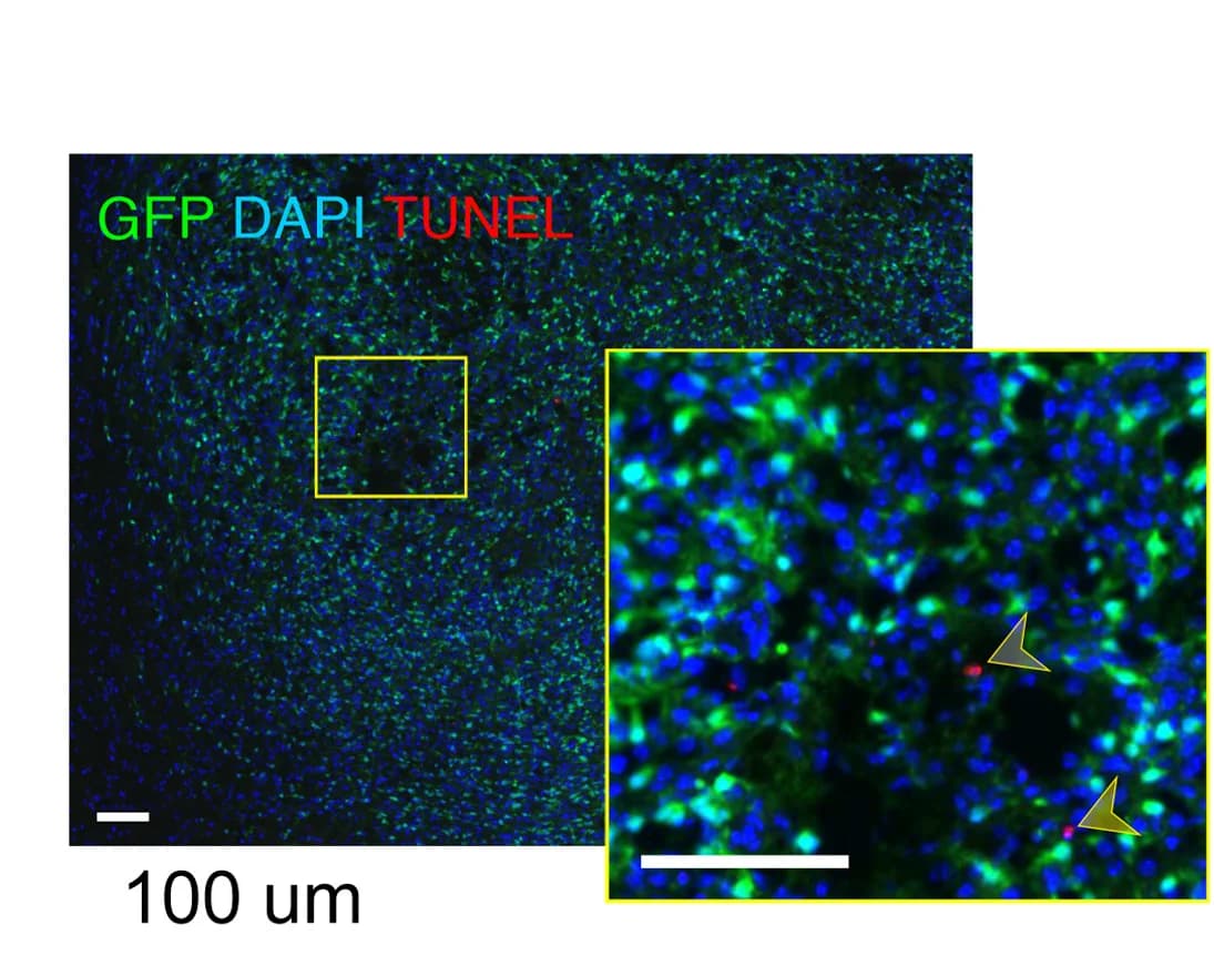 Open access visualization of Microscopy, Apoptotic Cells, Necrotic Cells, TUNEL Assay, Tumors