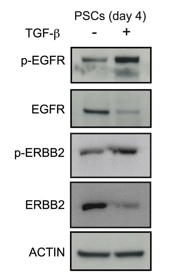 Open access visualization of Gel, Western Blot, p-EGFR, EGFR, p-ERBB2