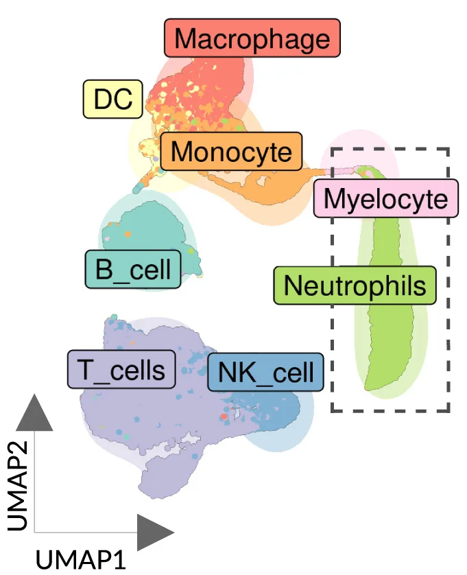 Open access visualization of Scatter Plot, UMAP, CD45+ Cells, Non-Small Cell Lung Cancer, scRNA-seq