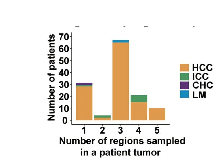 Open access visualization of Stacked Bar Plot, Histogram, Regional Sampling, Patients, Histological Subtypes