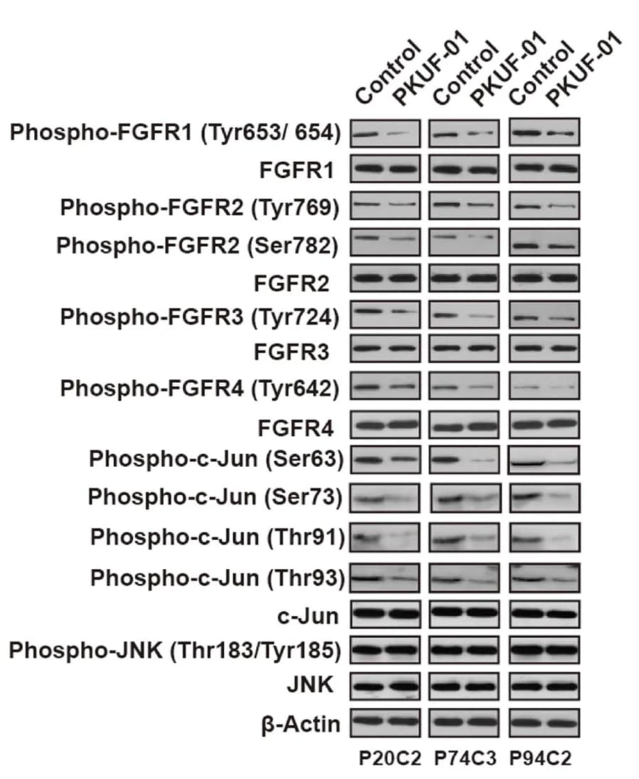 Open access visualization of Gel, Western Blot, FGFR, JNK, c-Jun
