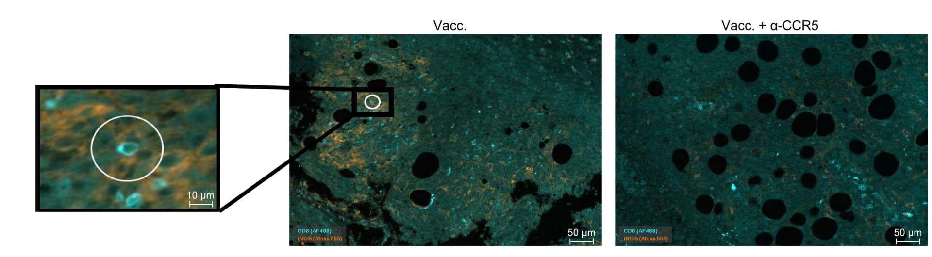 Open access visualization of Microscopy, Immunofluorescence Staining, CD8 Cells, iNOS