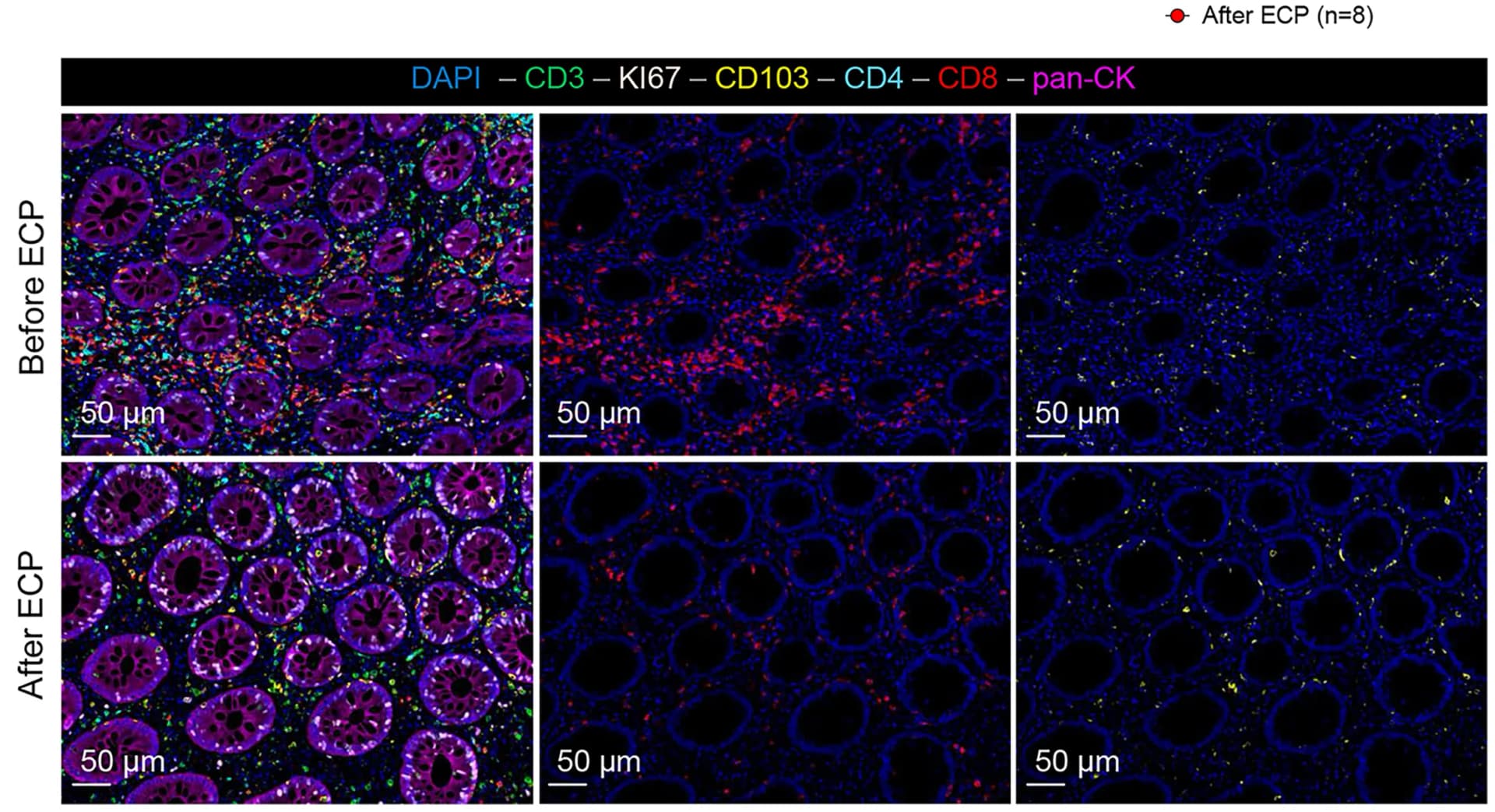 Open access visualization of Microscopy, Multiplex Immunofluorescence, Colon Tissue, ICI-Colitis, ECP Therapy