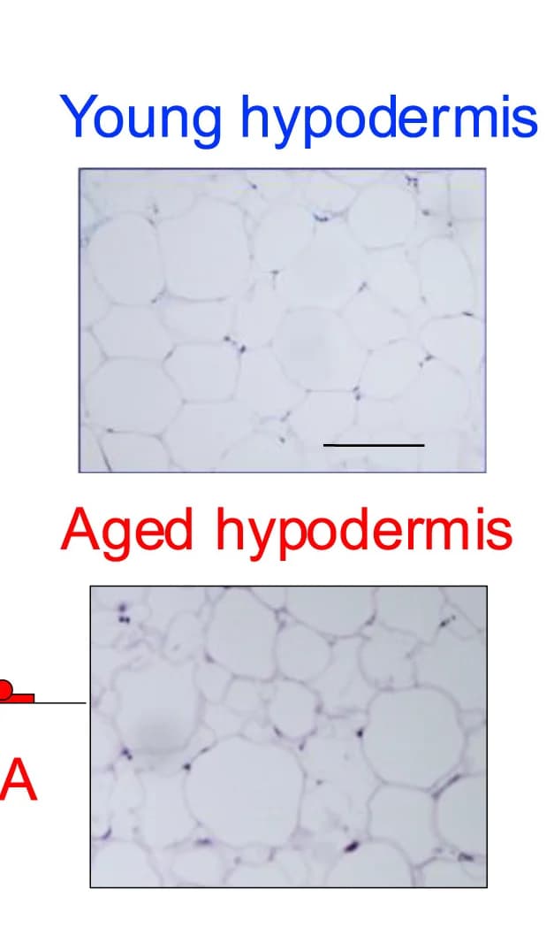 Open access visualization of Microscopy, H&E Photomicrographs, Hypodermis
