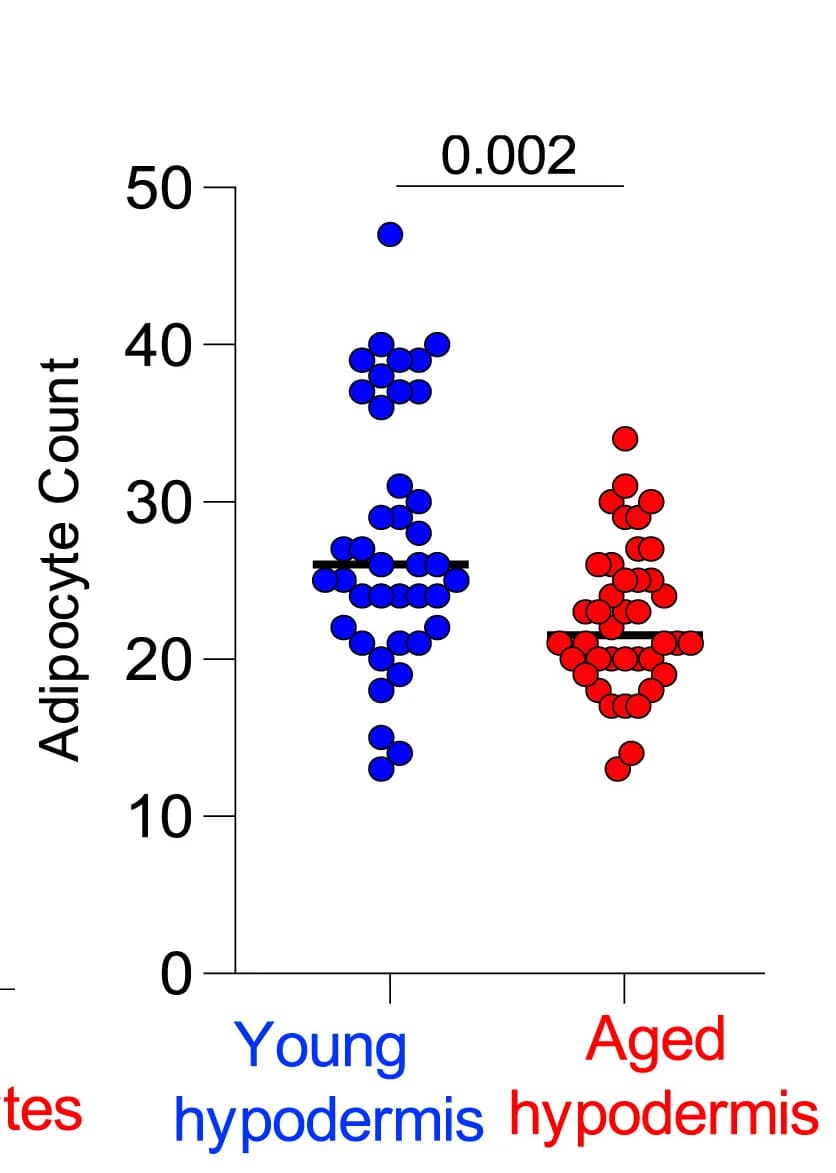 Open access visualization of Scatter Plot, Adipocyte Quantification, Abdominal Hypodermis