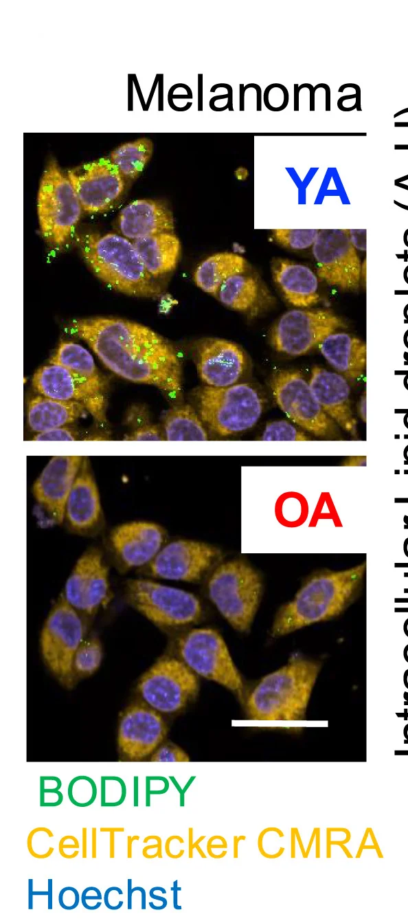 Open access visualization of Microscopy, Lipid Droplets, SKMEL28 Cells, Adipocyte Secretome, Hoechst