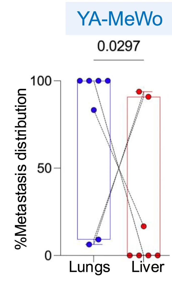 Open access visualization of Box Plot, Scatter Plot, Metastasis Distribution, Lungs, Liver