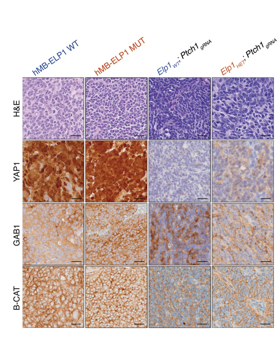 Open access visualization of Microscopy, ELP1-WT, ELP1-mutant, SHH-MB Tumors, Elp1WT;Ptch1gRNA