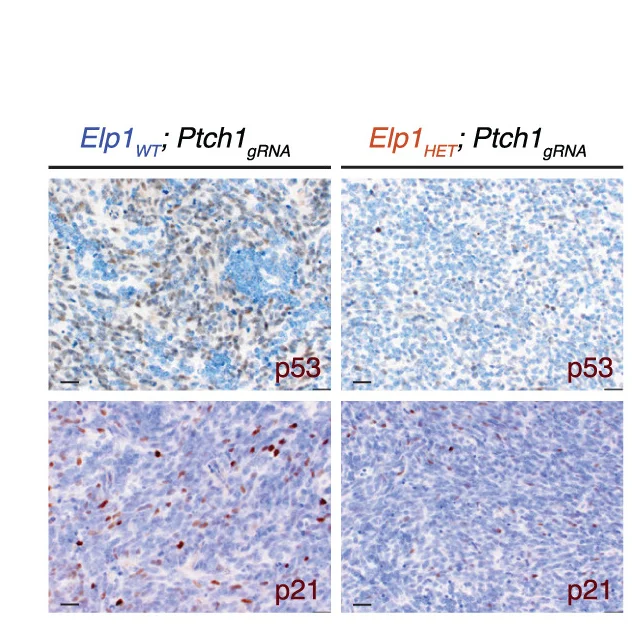 Open access visualization of Microscopy, IHC Images, p53 Protein, p21 Protein, Elp1HET;Ptch1gRNA
