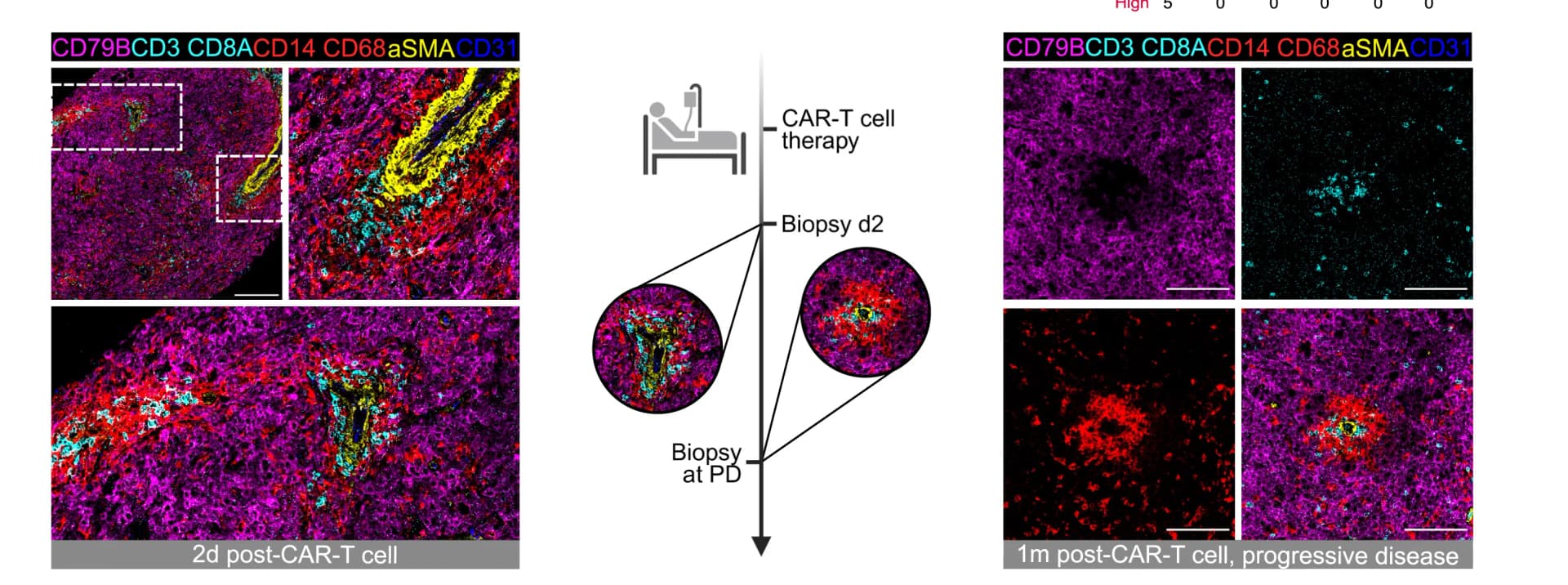Open access visualization of Microscopy, Workflow, Regions Of Interest, CAR-T Cell