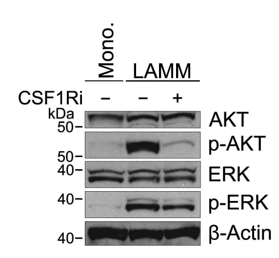 Open access visualization of Gel, Western Blot, Protein Analysis, Donors