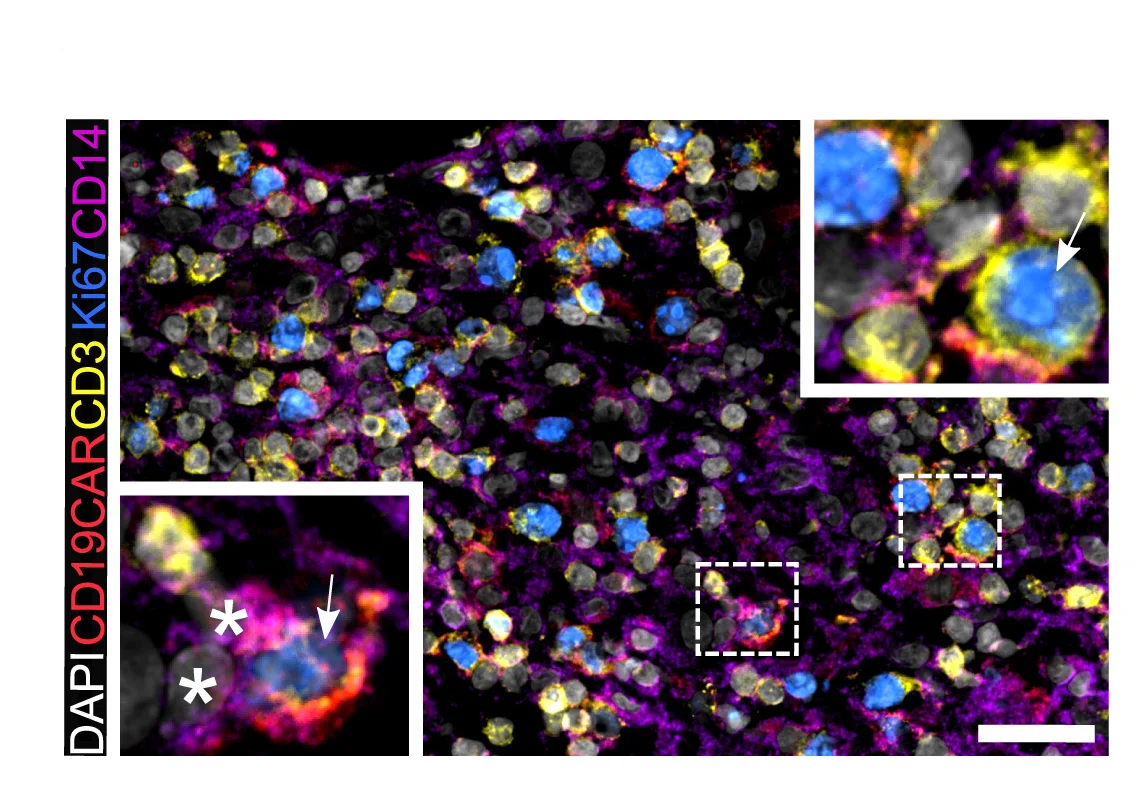 Open access visualization of Microscopy, CAR-T Cells, LAMM Cells, Representative Area