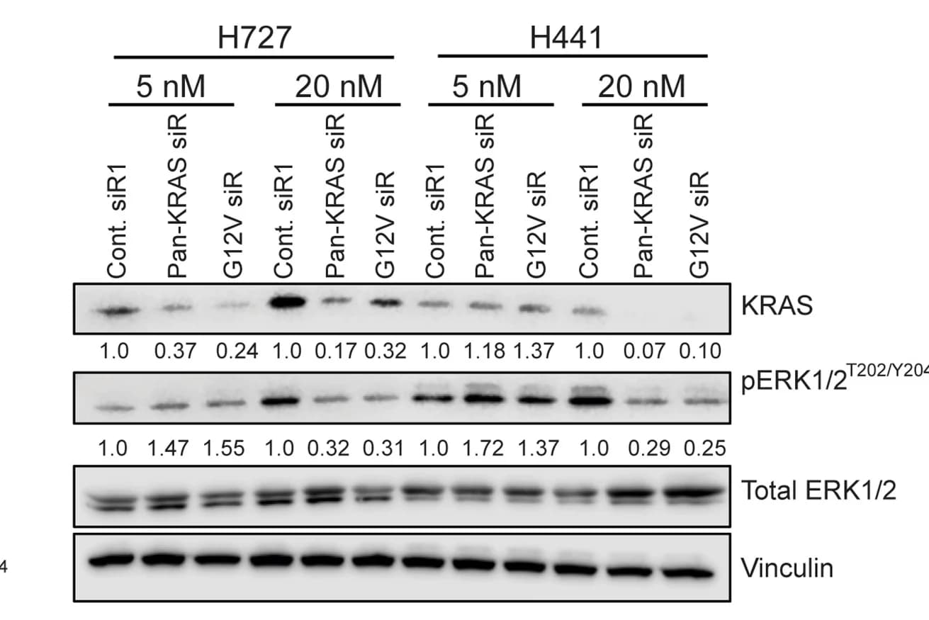 Open access visualization of Gel, Western Blot, Cells, siRNAs, Vinculin