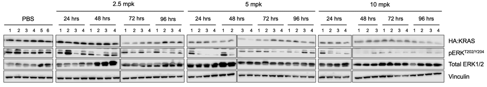Open access visualization of Gel, Western Blot, Tumor Lysates, Vinculin Control