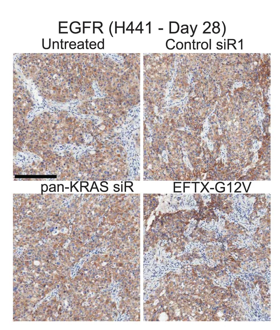 Open access visualization of Microscopy, EGFR IHC, H441, Xenograft Tumors
