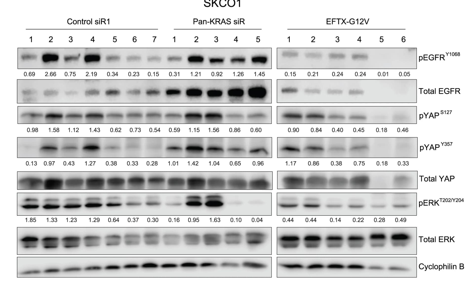 Open access visualization of Gel, Western Blot Analysis, SKCO1 Tumors, Cyclophilin B
