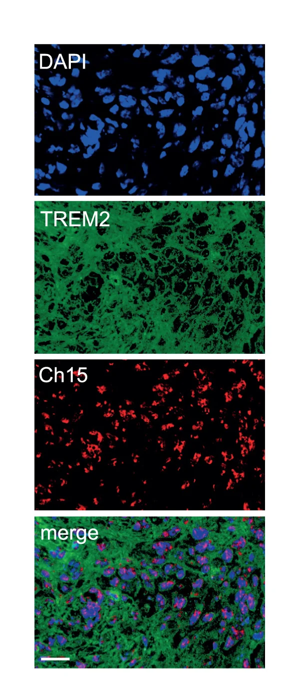 Open access visualization of Microscopy, TREM2, Immunofluorescence, Chromosome 15, FISH