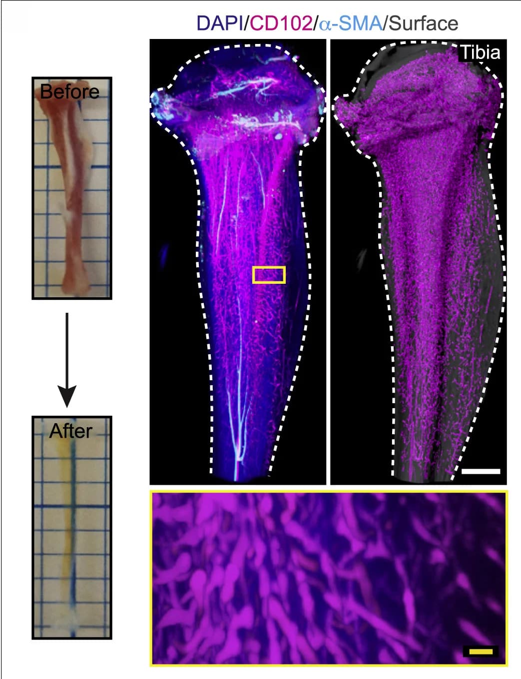 Open access visualization of Microscopy, Photo, Tibiae, Tissue Clearing, 3D Images
