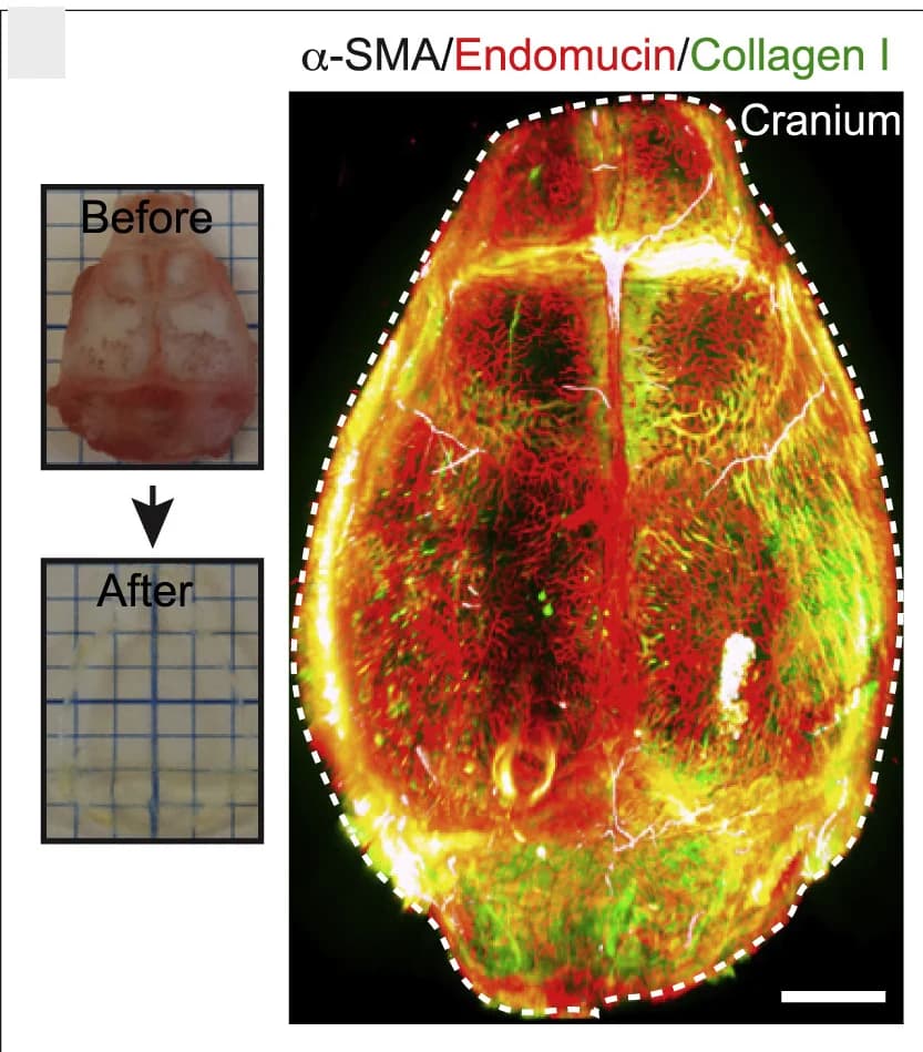Open access visualization of Microscopy, Photo, Murine Cranium, Tissue Clearing, α-SMA