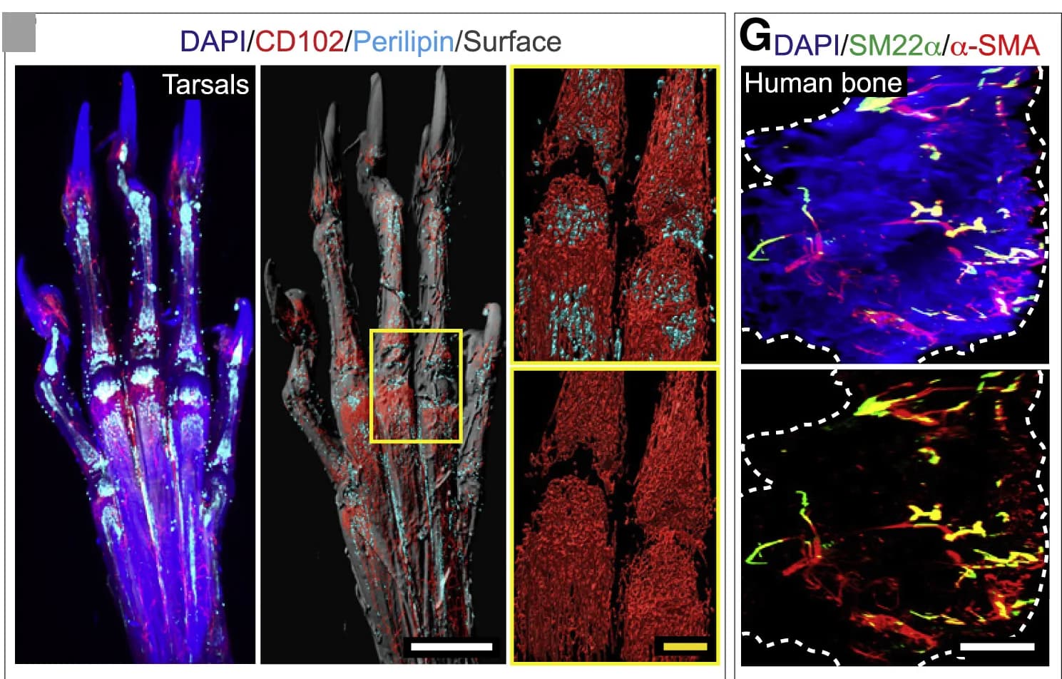 Open access visualization of Microscopy, Murine Tarsal Bones, DAPI, CD102, Perilipin