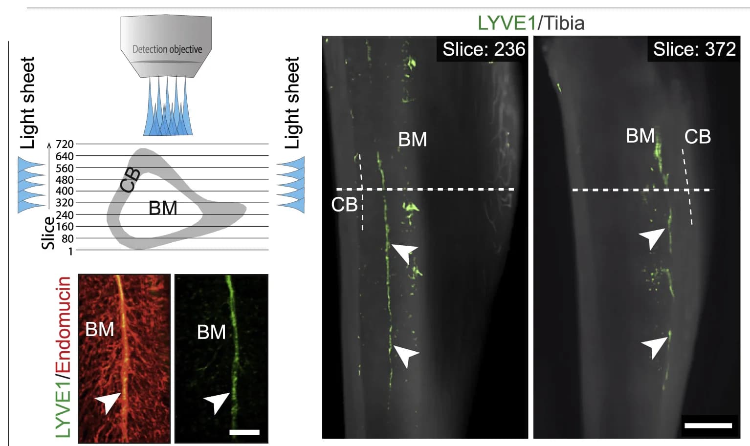 Open access visualization of Microscopy, Image Acquisition Strategy, Light-Sheet Microscopy, 3D Images, Tibia