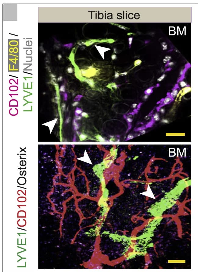 Open access visualization of Microscopy, 3D Image, Murine Tibia, CD102, F4/80