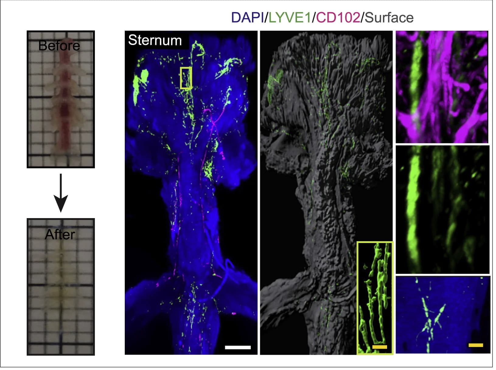 Open access visualization of Microscopy, Photo, Murine Sternum, Tissue Clearing, DAPI