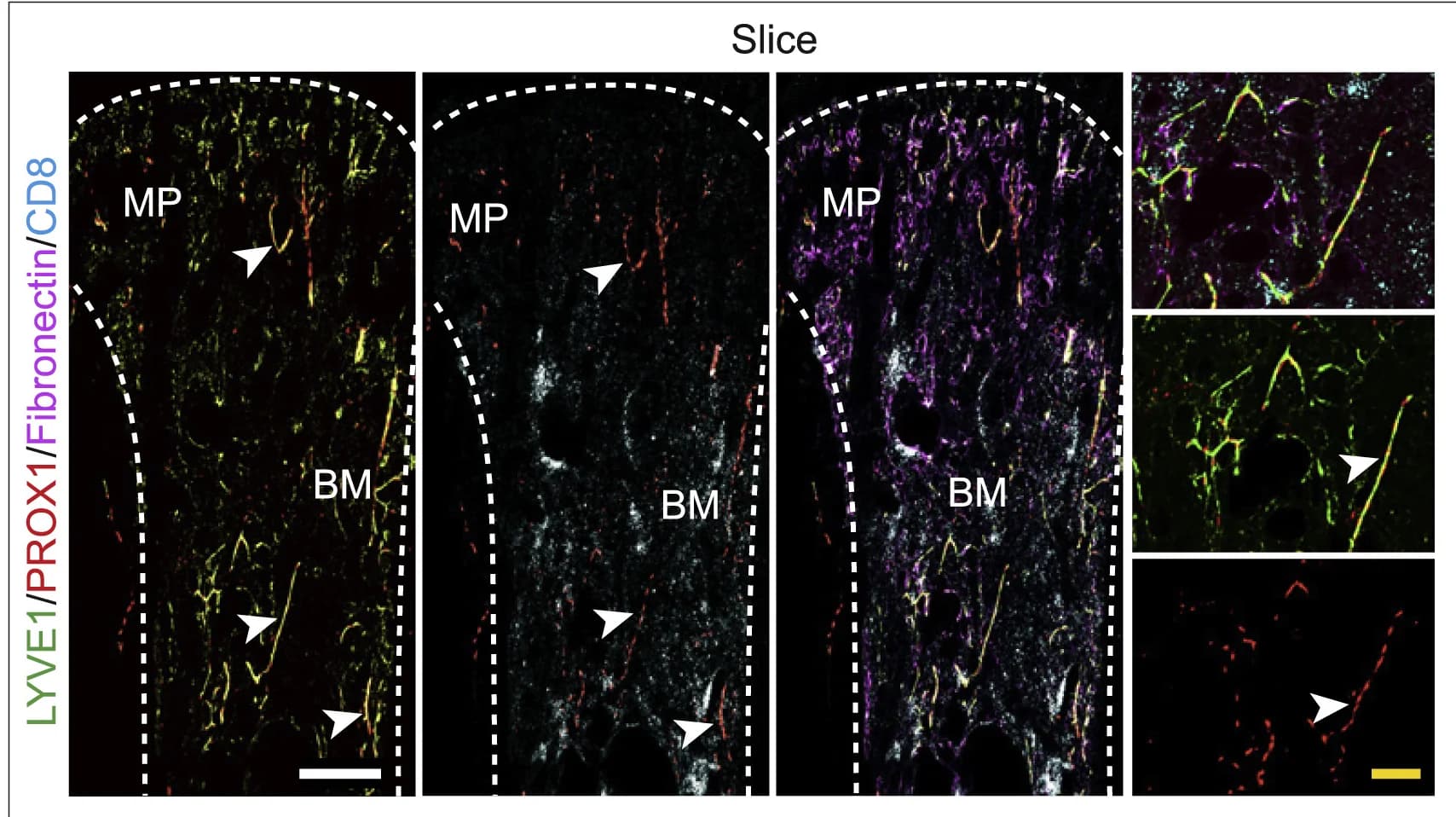 Open access visualization of Microscopy, 3D Images, Tibia, Immunostaining, LYVE1