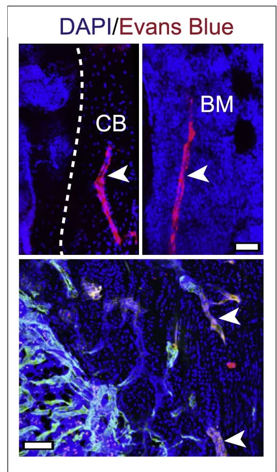 Open access visualization of Microscopy, 3D Images, Tibiae, Mice, Evans Blue Dye