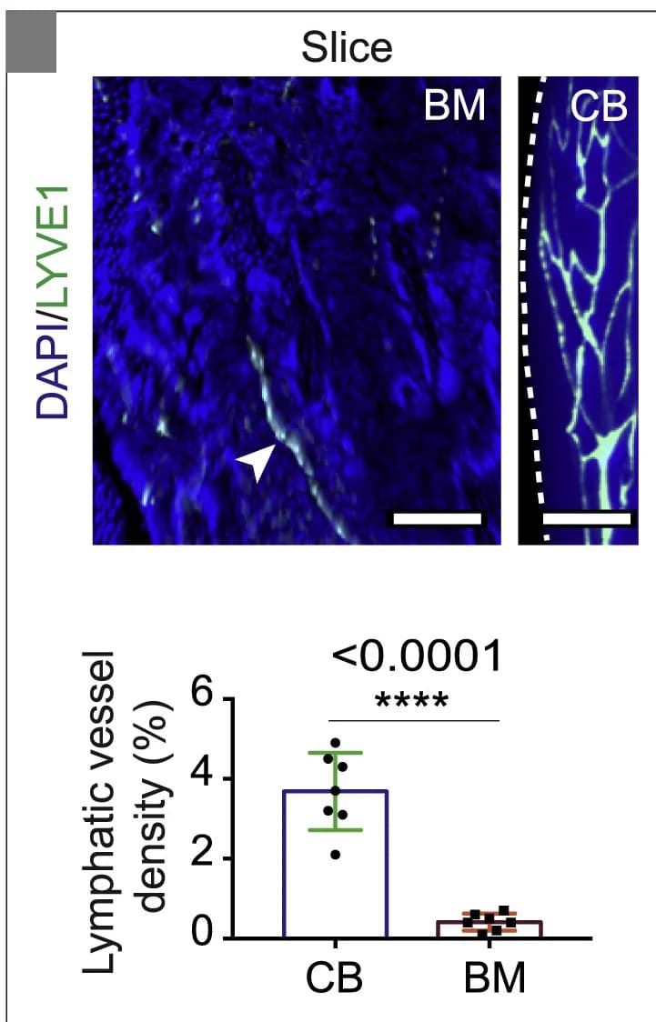 Open access visualization of Bar Plot, Error Bars, Microscopy, 3D Images, LYVE1-Positive Lymphatic Vessels