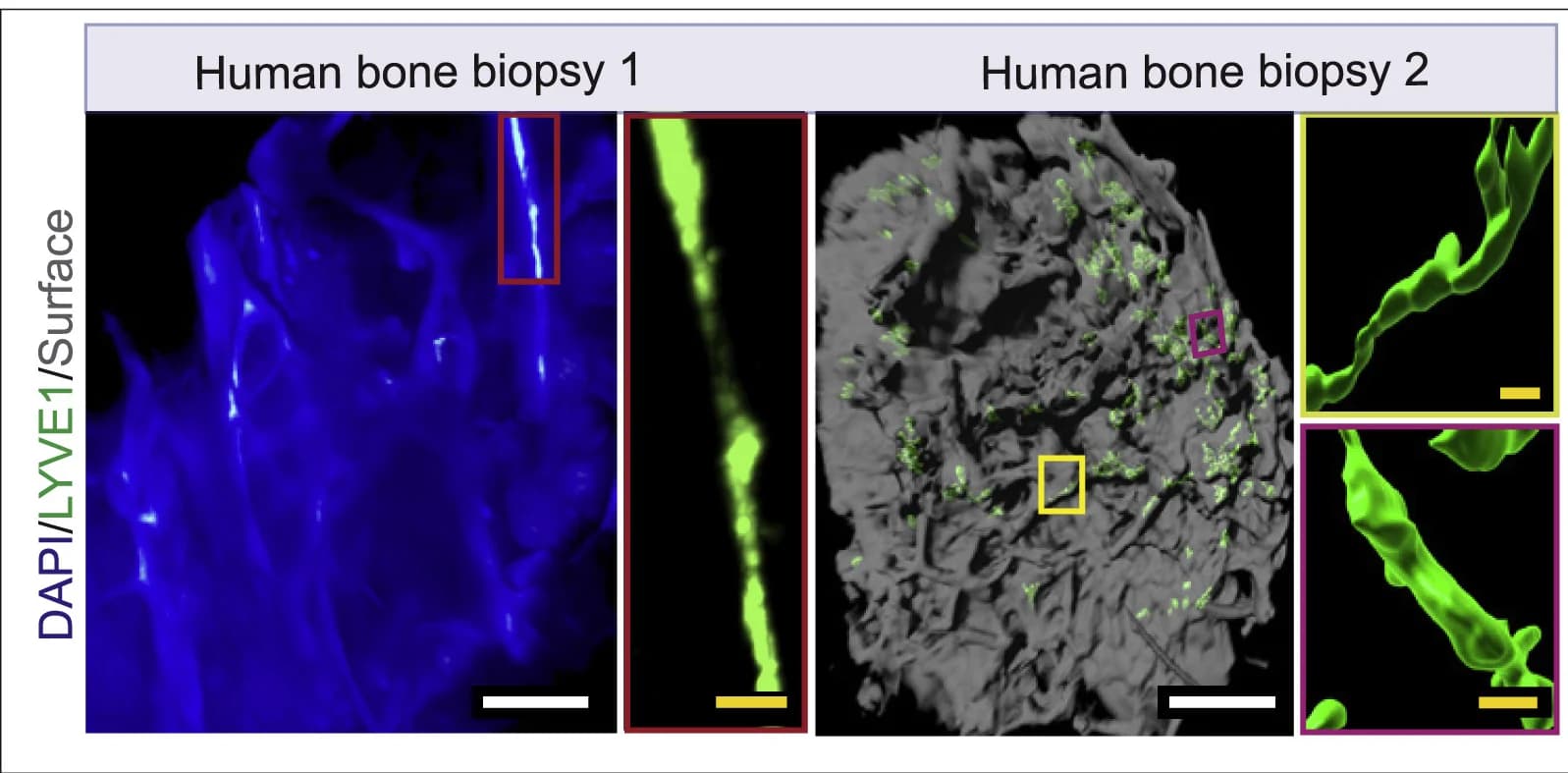 Open access visualization of Microscopy, 3D Images, Human Bone Marrow Biopsies, LYVE1, DAPI
