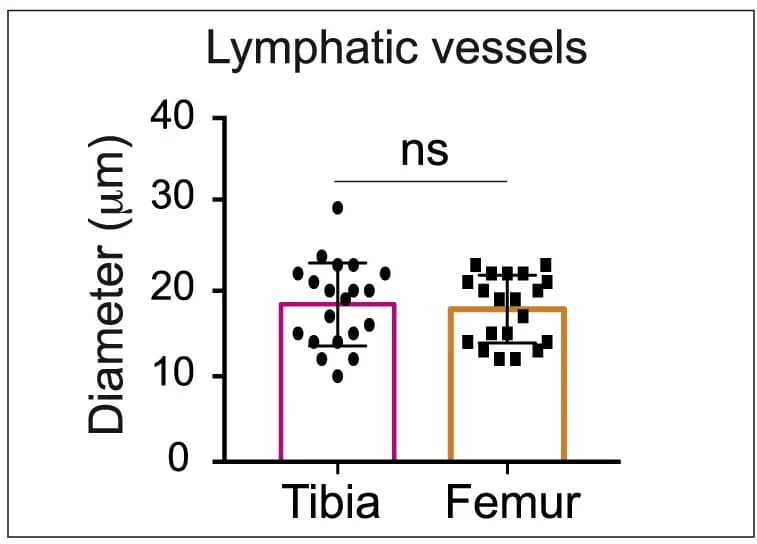Open access visualization of Bar Plot, Error Bars, UMAP Projection, Single Cells, Human Bones