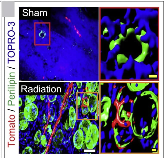 Open access visualization of Microscopy, 3D Images, Tibiae, Tomato, Perilipin