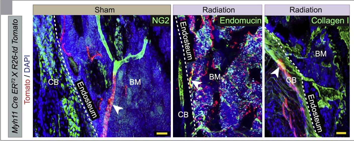Open access visualization of Microscopy, 3D Images, Tibiae, Myh11 Cre ERT2X R26-td Tomato mice, Tomato