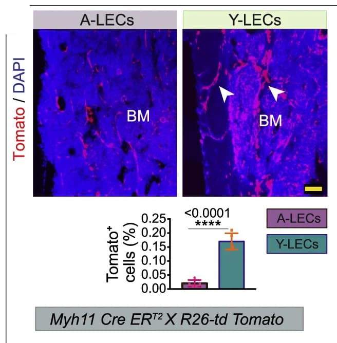 Open access visualization of Bar Plot, Error Bars, 3D Images, Tibiae, Myh11 Cre ERT2X R26-td Tomato aged mice