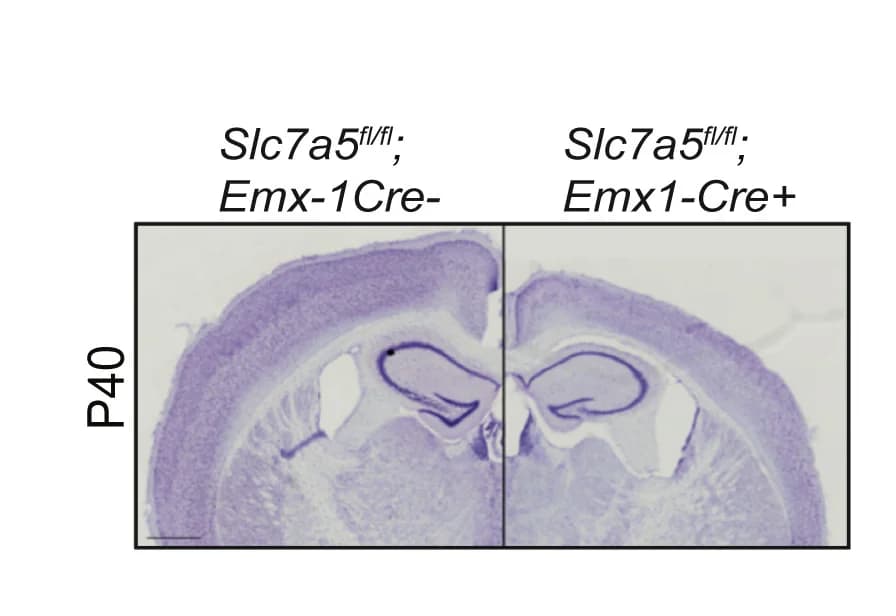 Open access visualization of Microscopy, Images, Nissl-stained coronal sections