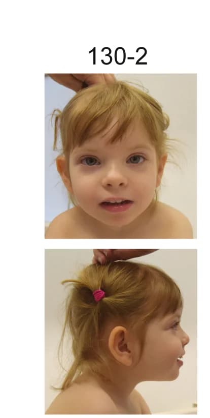 Open access visualization of Photo, Images, Patient