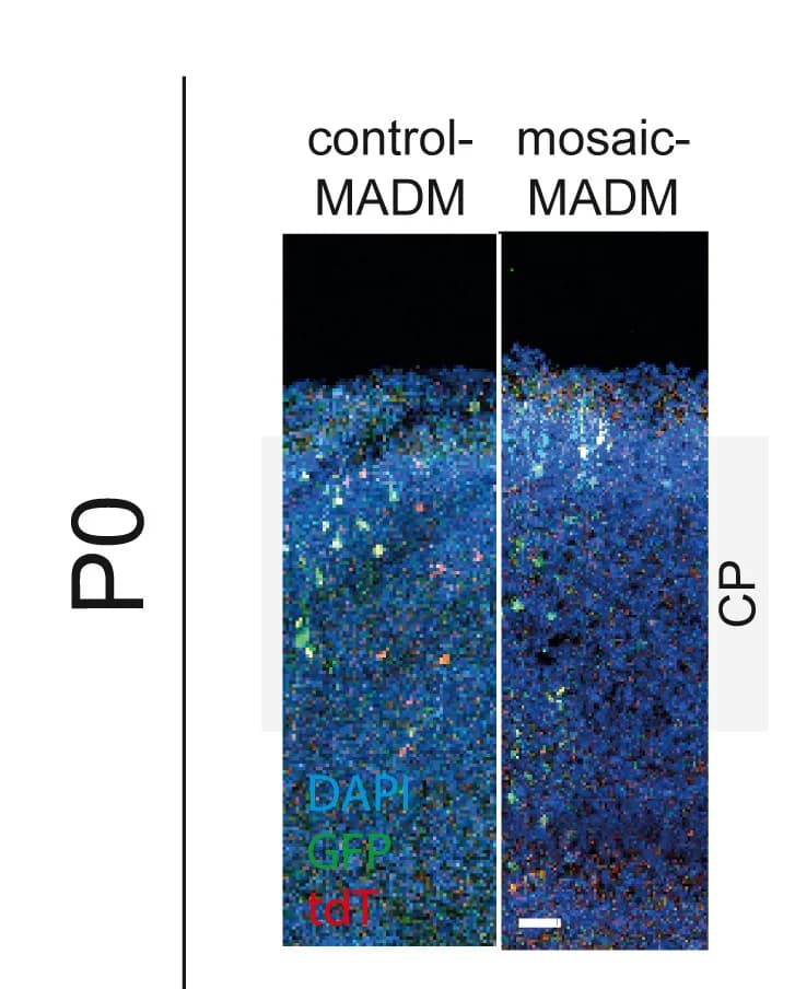 Open access visualization of Microscopy, Coronal Sections, Green/Red Cell Ratio, MADM-labeled Neurons, Cortical Plate