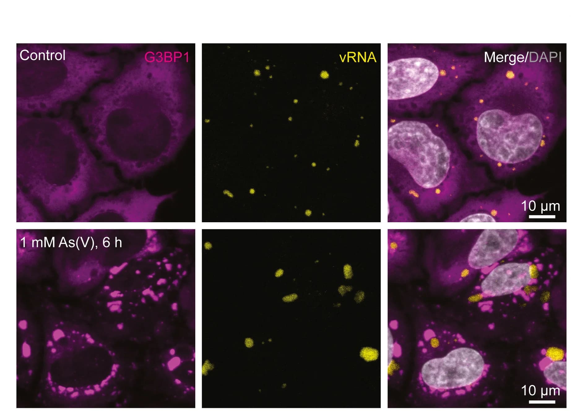 Open access visualization of Microscopy, HeLa-MuV Cells, RNA FISH, Stress Condition, Quantification