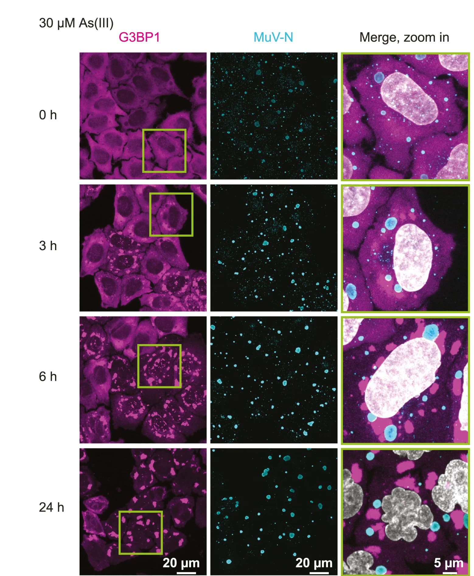 Open access visualization of Microscopy, MuV Factories, Stress Granules, HeLa-MuV Cells, Immunostaining