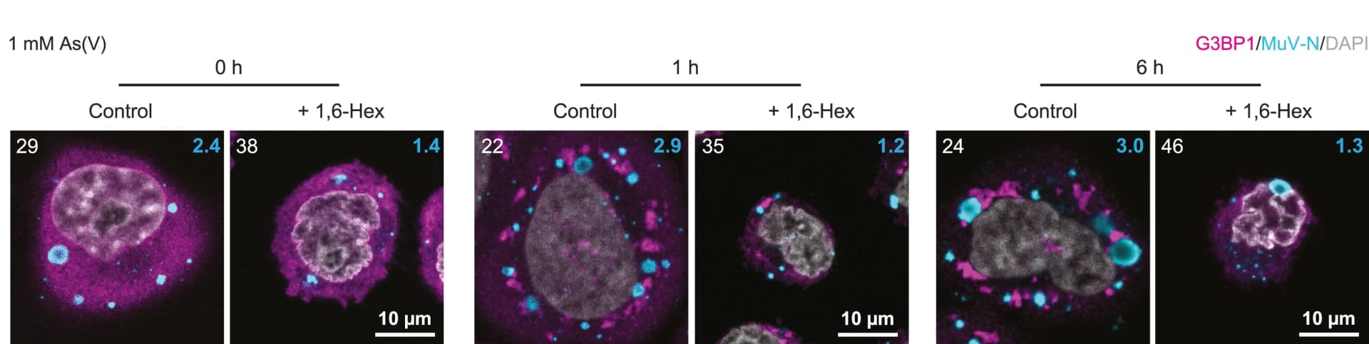 Open access visualization of Microscopy, 1,6-Hexanediol, MuV Factories, Time Course, HeLa-MuV Cells