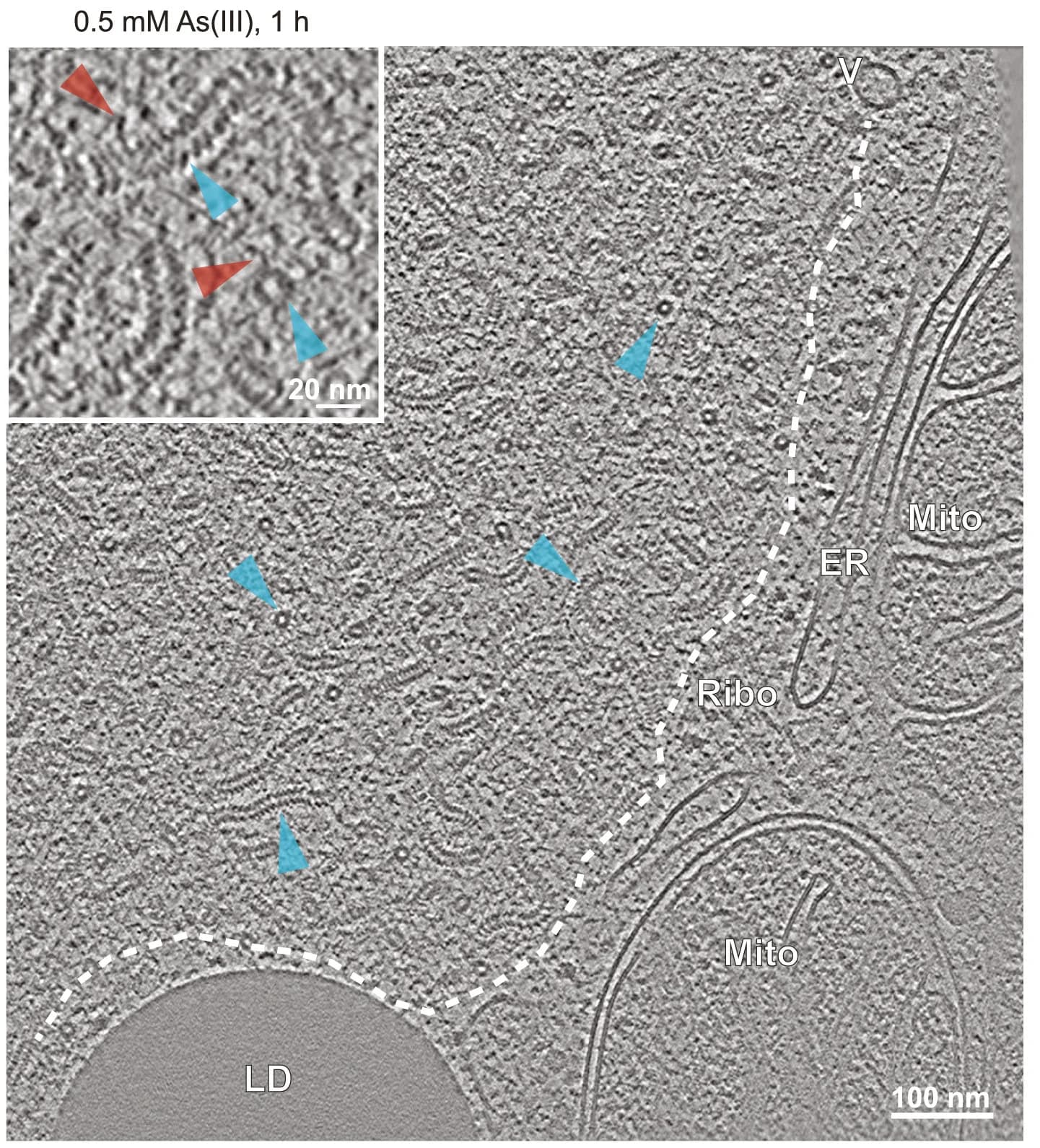 Open access visualization of Microscopy, Tomographic Slice, 3D Segmentation, Nucleocapsids, Lipid Droplet