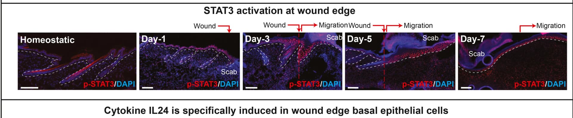 Open access visualization of Microscopy, Homeostatic Skin, Wounds, Sagittal Sections, p-STAT3